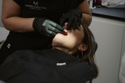 estetica dental